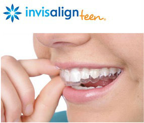 Invisalign put on - Garn & Mason Orthodontics in Phoenix, AZ